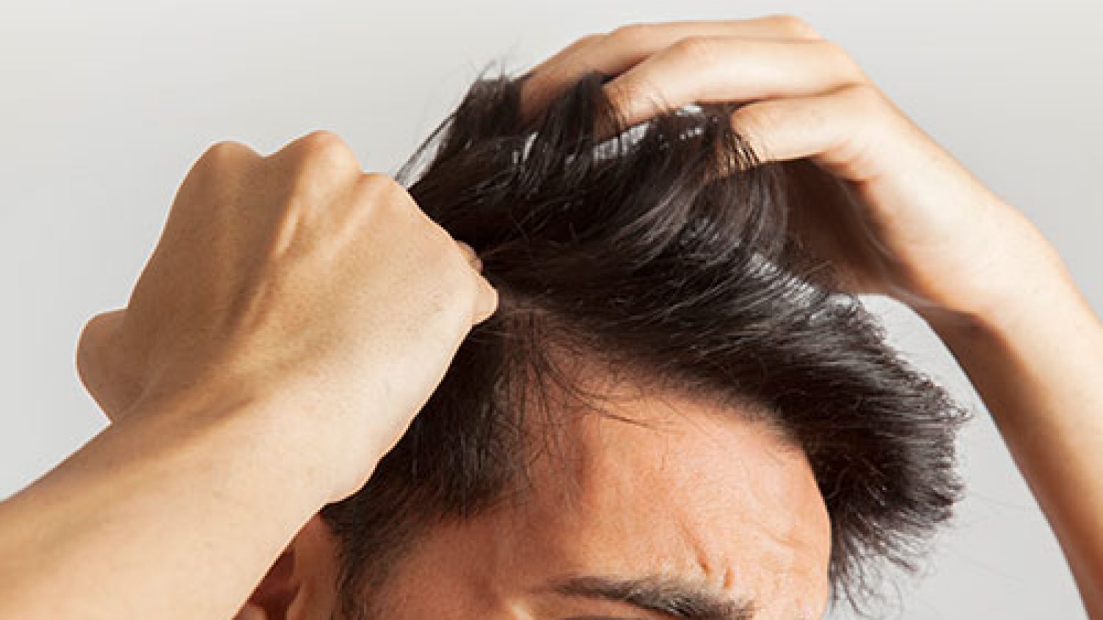 62967349b336654676ecaa12_HAIR-TRANSPLANT-IN-THE-UK