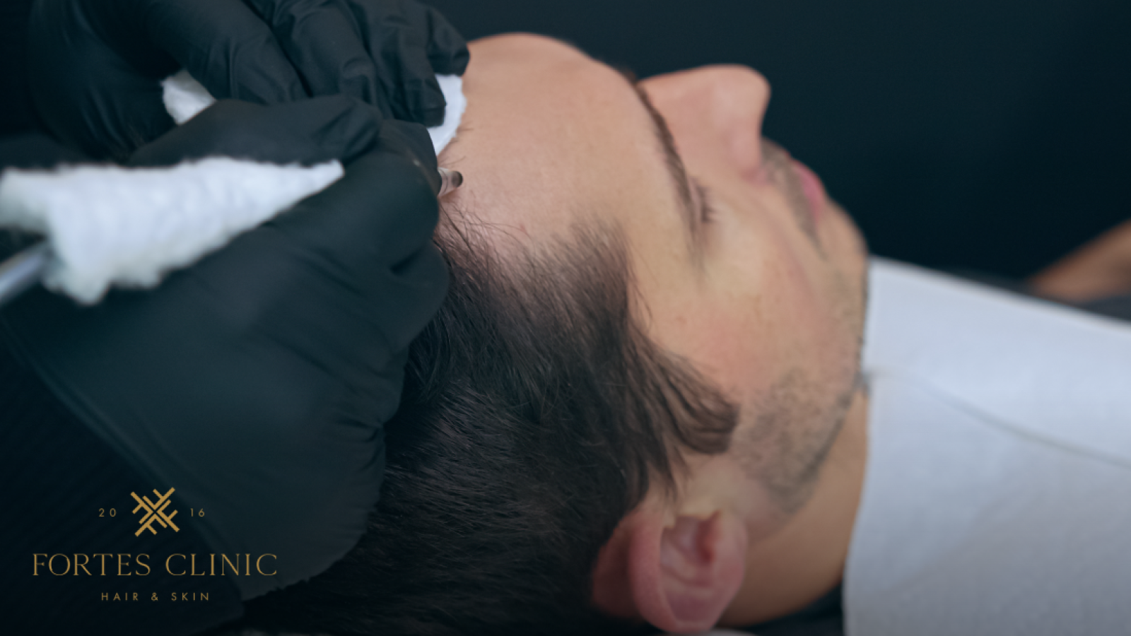 64b159d2845a4e64b05bcdce_1642517_FortesClinicBlogImagery22_052223