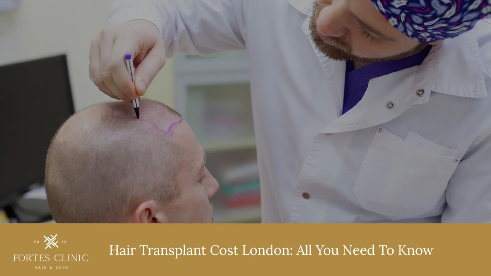 Hair-Transplant-Cost-London_-All-You-Need-To-Know-1