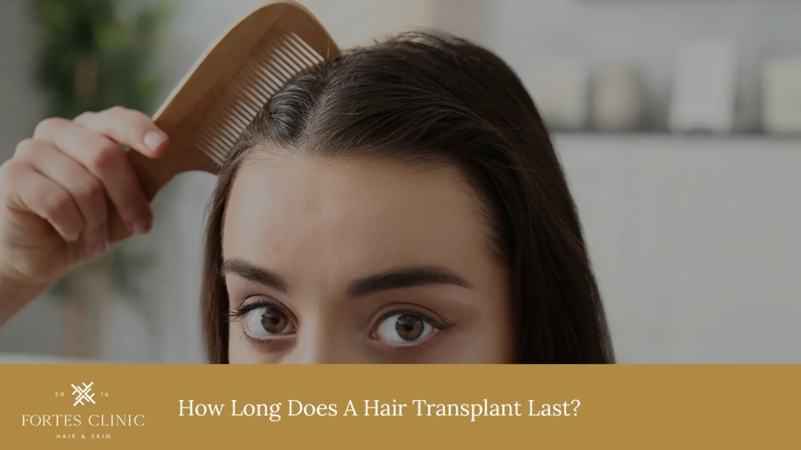 How-Long-Does-A-Hair-Transplant-Last_
