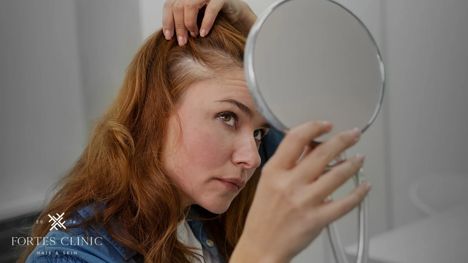 Understanding-Female-Pattern-Baldness