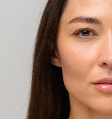 Paul Wilson Aesthetics - Secondary Rhinoplasty