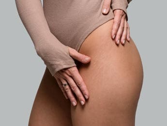 Paul Wilson Aesthetics - Thigh Lift