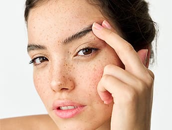 Brow Lift Surgery | Brow Lift | Brow Lift Before and After