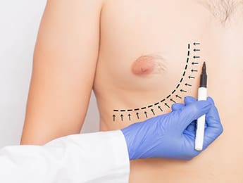Gynecomastia Surgery | Gynecomastia Surgery Cost | Male Breast Reduction Surgery
