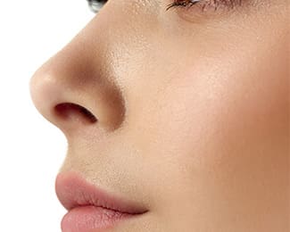 Non-Surgical Rhinoplasty | Filler Nose Job |What is Non-Surgical Rhinoplasty