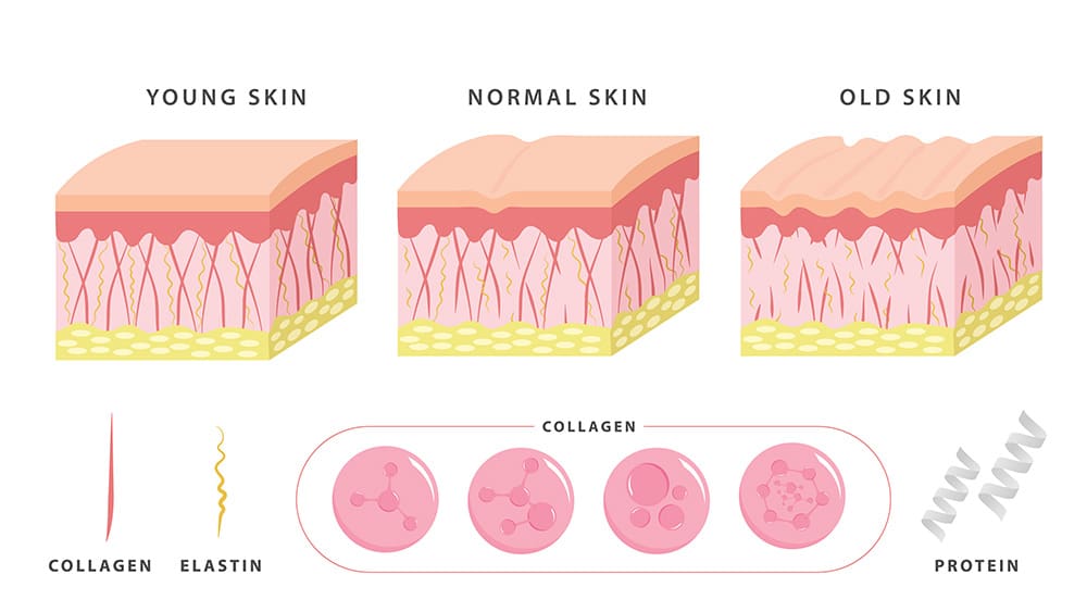 Anti Wrinkle Injections | Wrinkle Reduction Injections | Anti Wrinkle Treatment