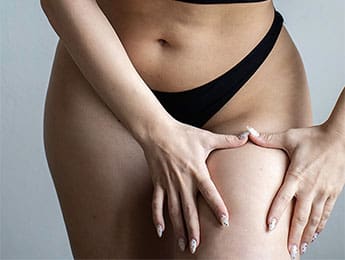 Thigh Liposuction | Thigh Reduction | Thigh Reduction Surgery